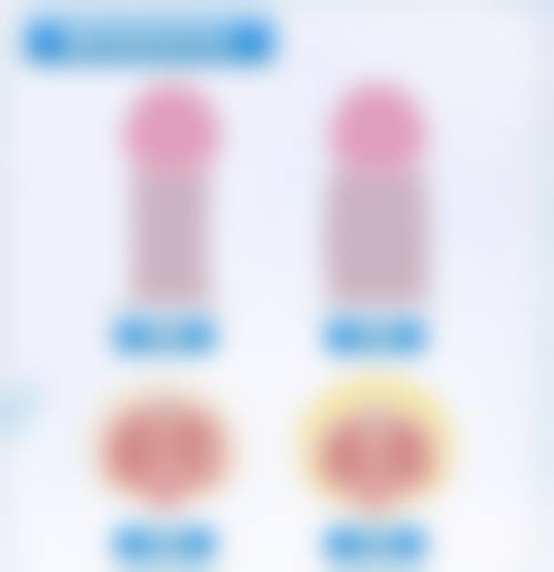 东莞华美医疗美容医院钟展芳医生收费价格