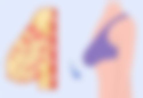 问题五:疤痕处理方式有哪些呢?有什么注意事项?