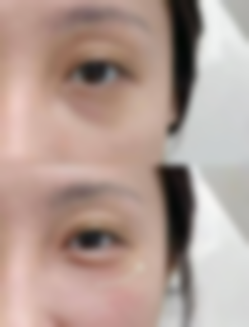 黛元堂眼霜能改善哪些类型的眼袋呢?