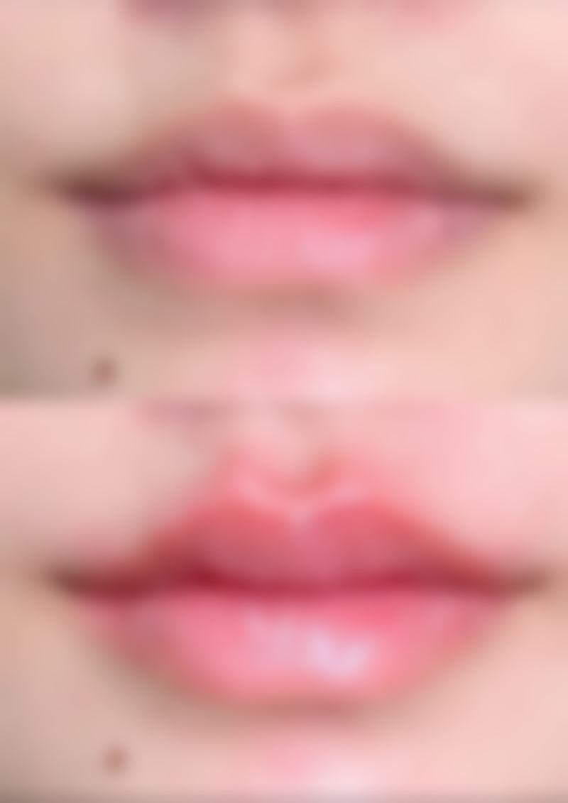 热敷按摩能改善小孩的眼袋和黑眼圈吗？具体怎么做呢？