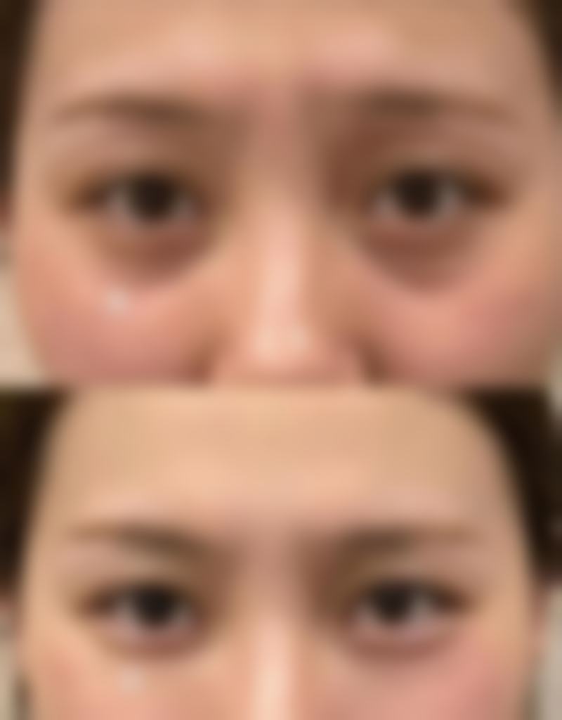 出现重度异常反应该怎么办？