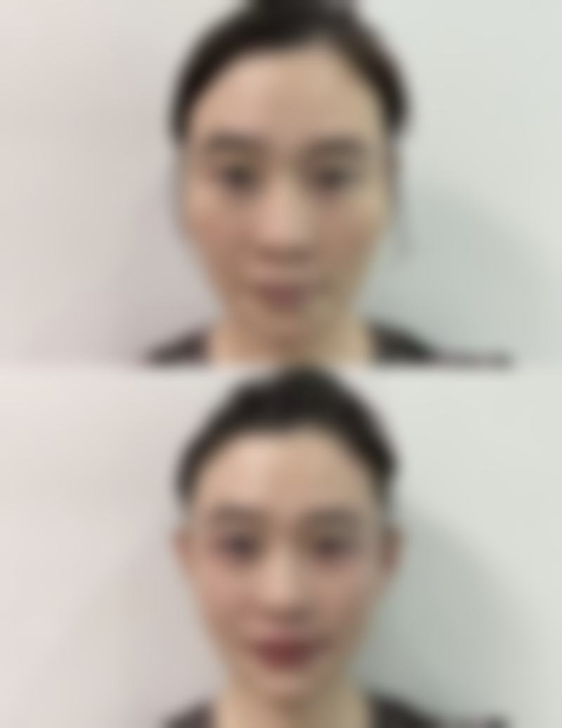 厦门欣赫拉整形医院正规吗?