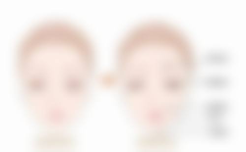 南京美莱整形医院口碑评价怎么样？