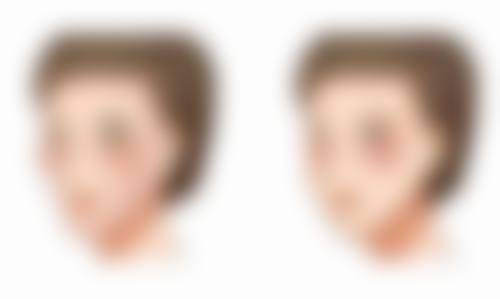 重庆第六人民医院整形美容科胡运春医生种胡须技术怎么样?