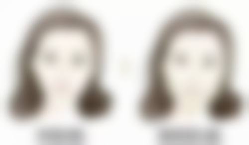 日常该如何预防和减轻眼袋？