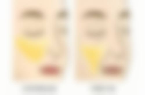 假体隆胸多久可以打九价？揭秘安全间隔与最佳时机！一般术后3 - 6个月打更安全吗？ 