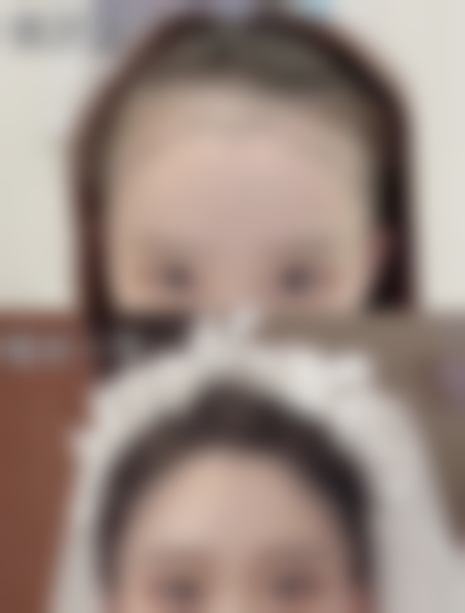 东莞华美医疗美容詹慧医生预约挂号指南