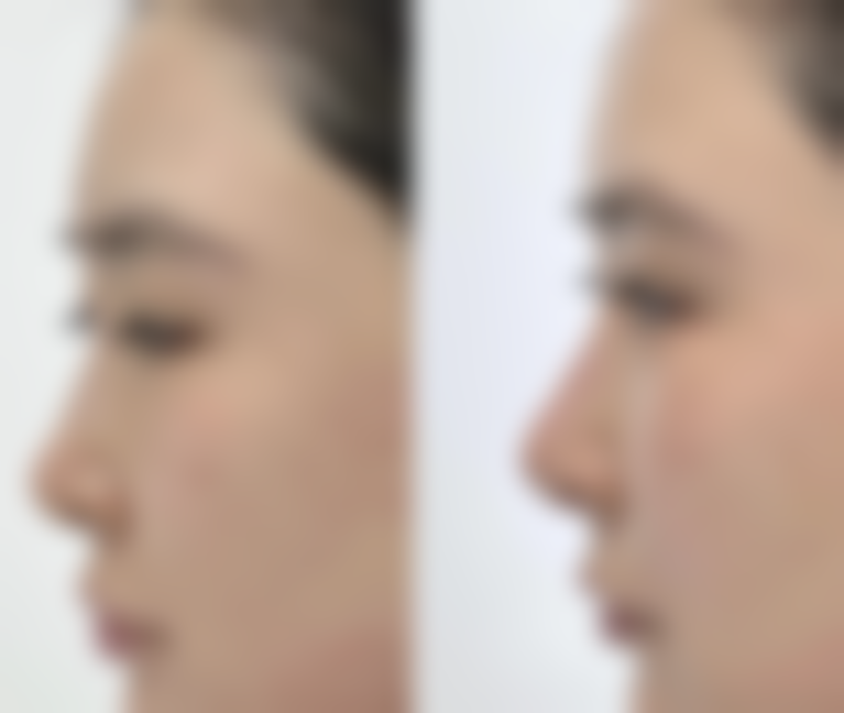 重庆第六人民医院整形美容科胡运春医生擅长项目