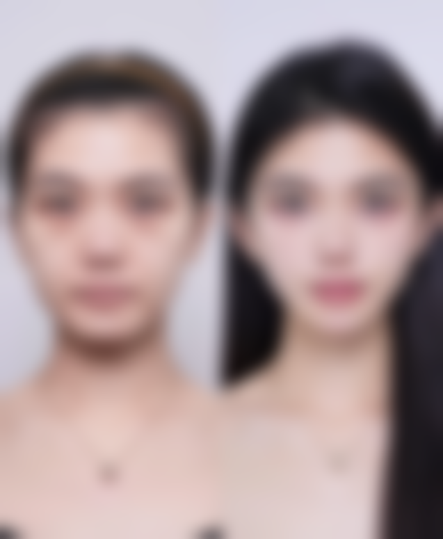 重庆第六人民医院整形美容科邵雅娟医生擅长项目