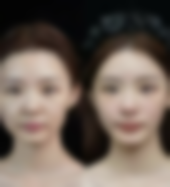 佛山亚美医疗美容门诊部口碑评价怎么样？