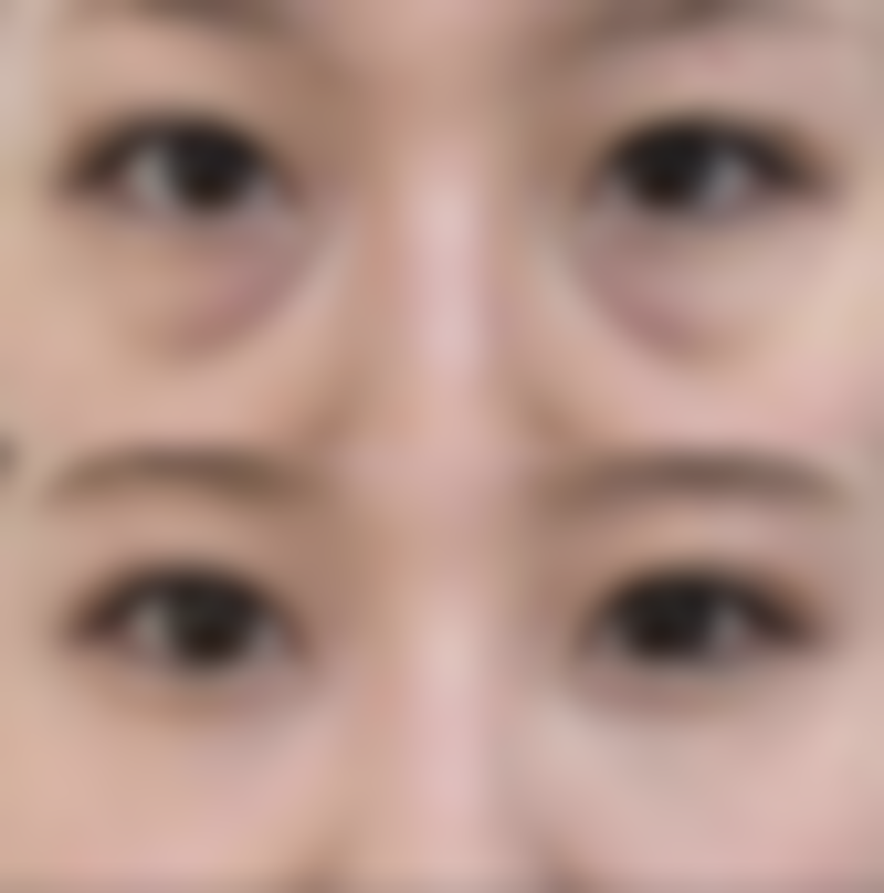 一般建议术后多久内避免接种疫苗呢？