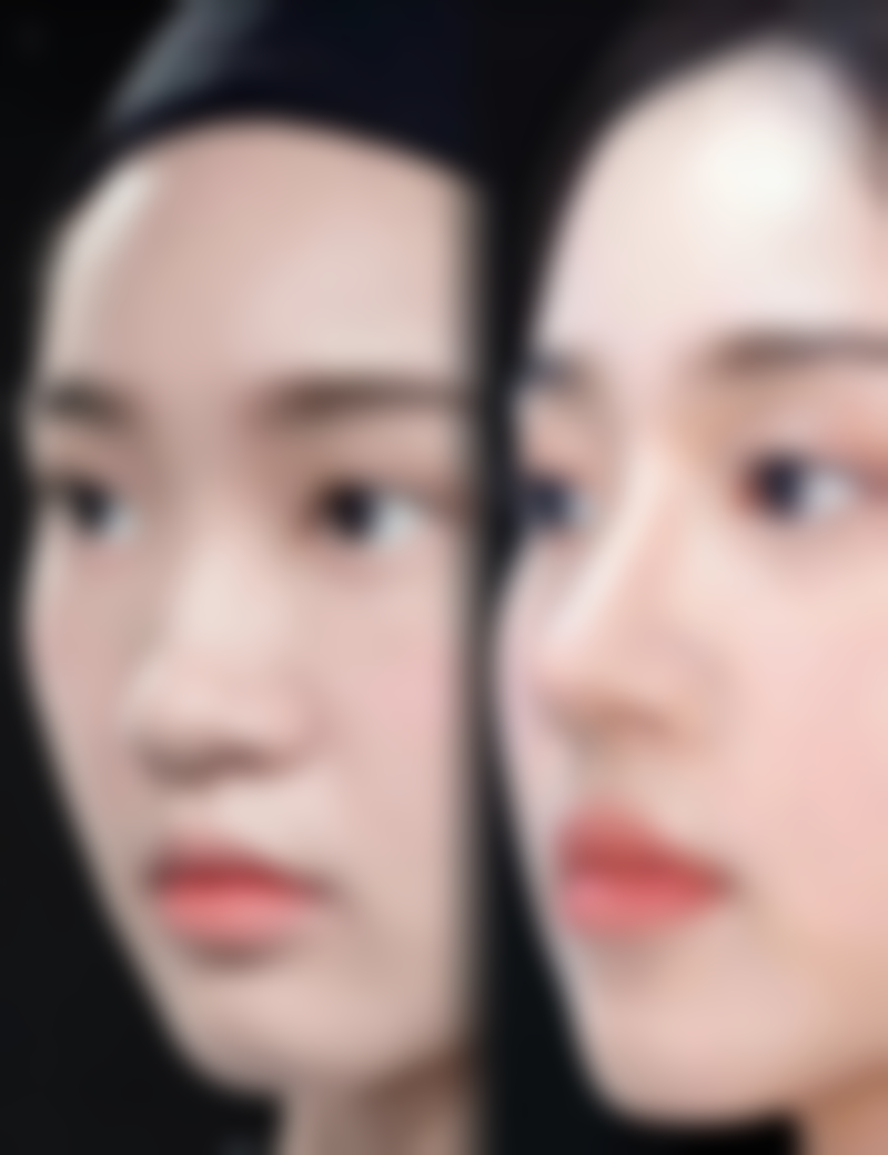 2. 手术治疗适合哪些疤痕，有什么风险？