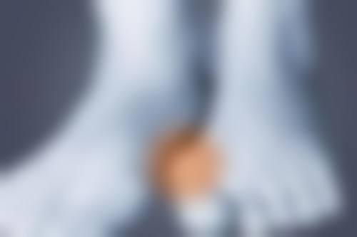 东莞华美医疗美容医院钟展芳医生收费价格