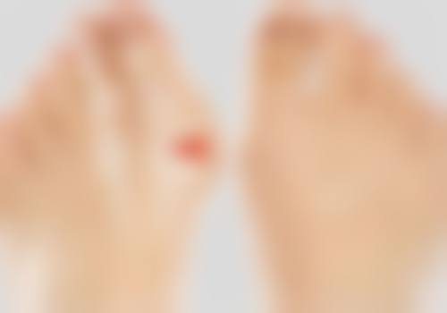 疤痕皮肤能治疗好吗？揭秘有效疗法与真实案例！答案是多数可改善，激光等疗法很给力！ 