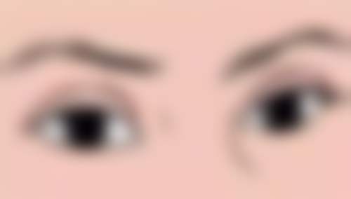 东莞华美医疗美容詹慧医生眼部整形技术怎么样?