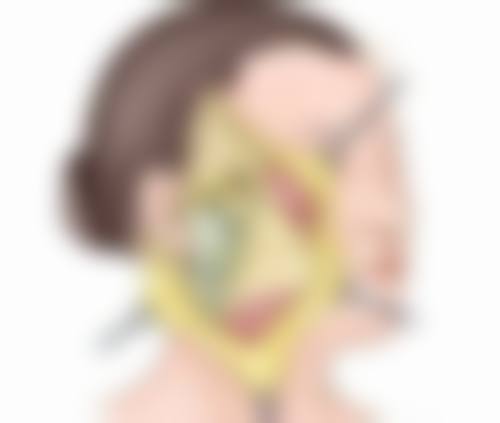 怎样才能改善眼袋泪沟？方法三：医美手段之重度松弛解决