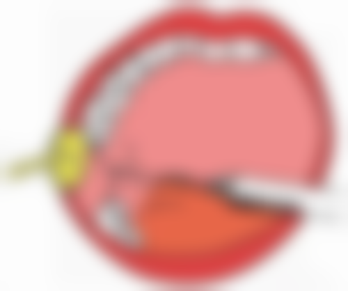 怎么加速瘦脸针代谢？5个实用技巧让你快速见效！这些技巧具体是啥呢？ 