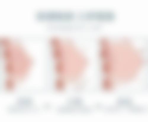 东莞华美医疗美容陈群医生预约挂号指南