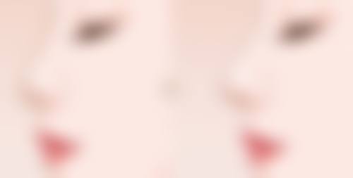 手臂抽脂后皮肤会松弛吗？