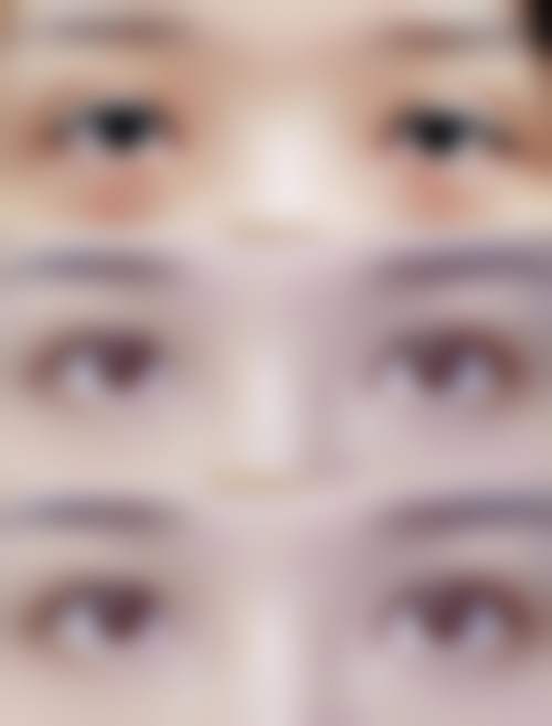 上海申江医院整形美容科王玉如医生收费价格