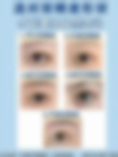 上海申江医院整形美容科王玉如医生患者评价