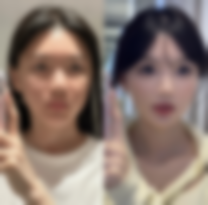 东莞华美医疗美容陈群医生患者评价