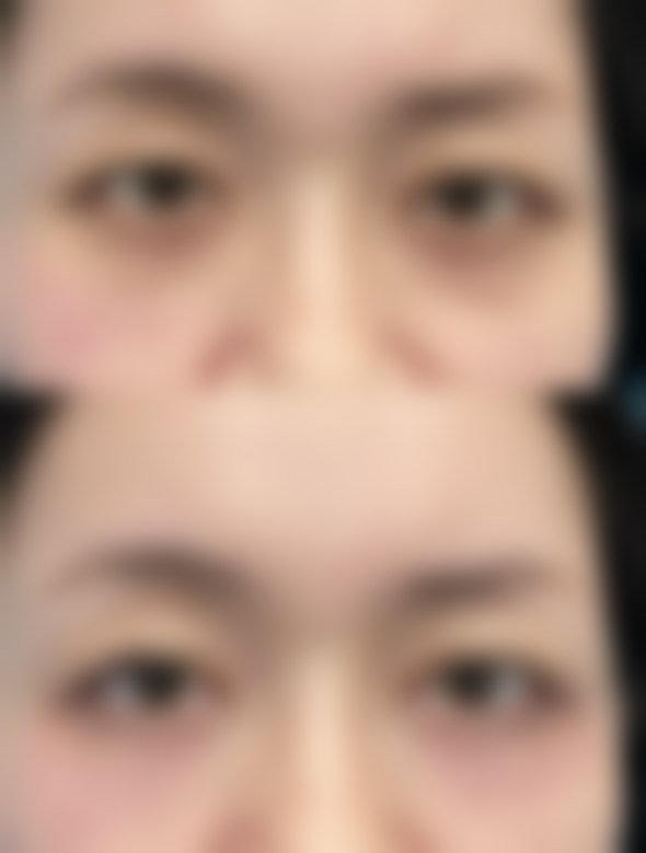 重庆第六人民医院整形美容科彭艳里医生患者评价