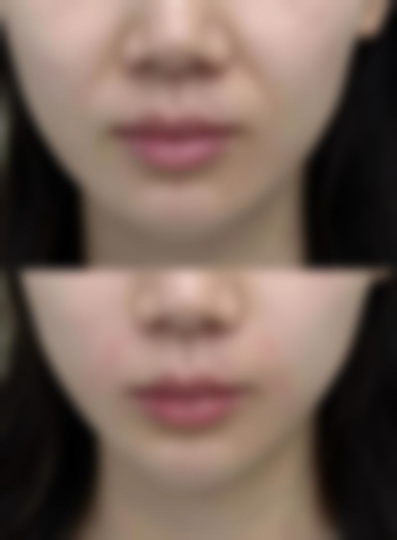 东莞华美医疗美容医院钟展芳医生预约挂号指南