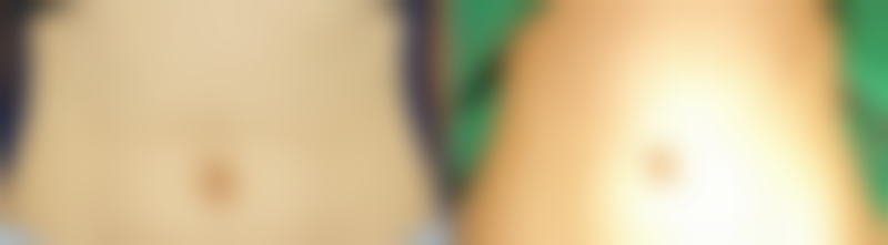 东莞华美医疗美容陈群医生擅长项目