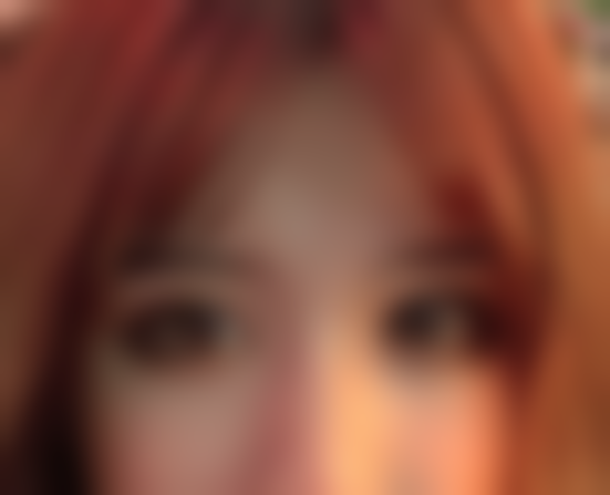 重庆松山医院医学美容科眼综合项目体验：医生专业靠谱，术后双眼一致大小超满意！ 