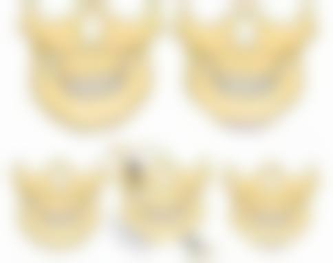 使用金霉素眼膏去眼袋存在哪些常见误区和风险?