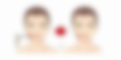 东莞莞南皮肤病医院能修复缝针疤痕发白问题吗？