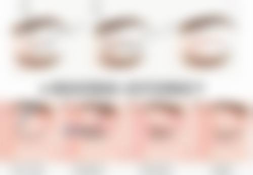 疤痕形成超过一年后该怎么处理？