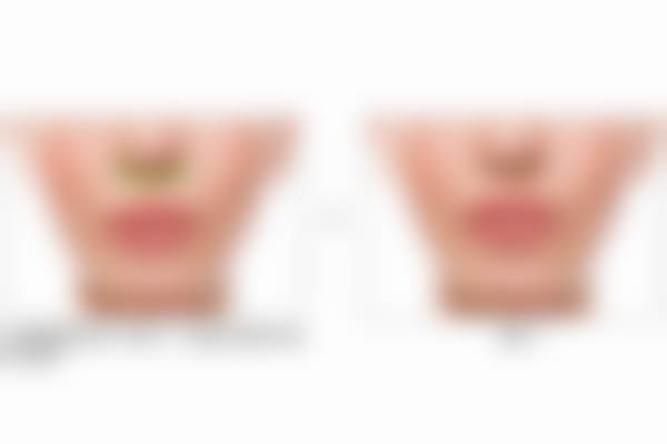 北京蕾士悦容医疗美容门诊部秦小鹏医生擅长项目