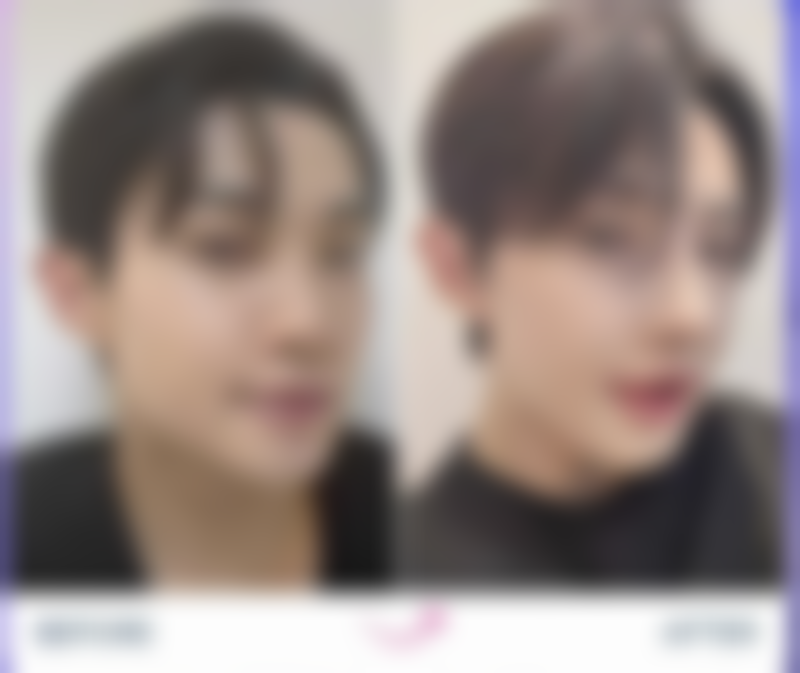 额头疤痕多久能恢复？揭秘恢复过程与护理技巧！恢复时间受哪些因素影响？ 