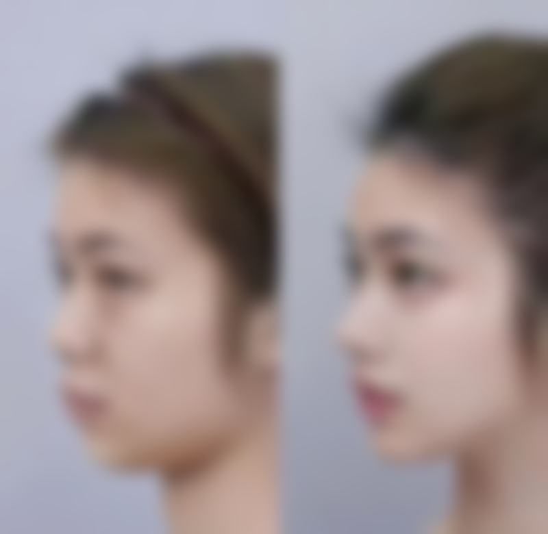 从美学视角,怎么管理眼袋呢?