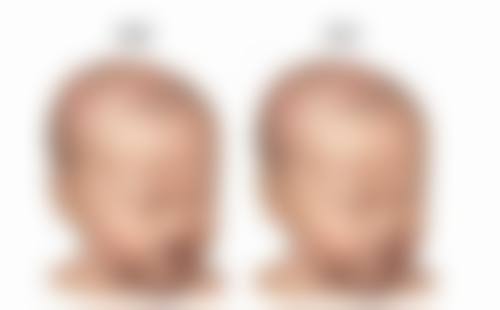 在选择改善方法时,有什么建议和注意事项?