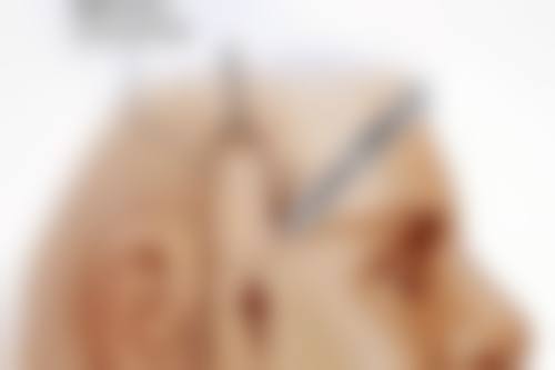 术后护理对留疤有多大作用呢？