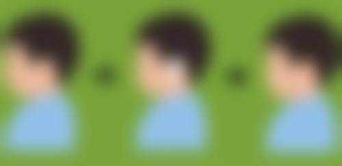 全麻有什么优势呢?