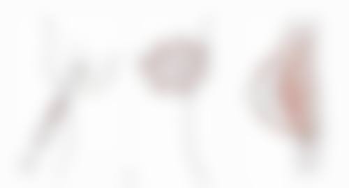 双眼皮提肌感觉太紧了怎么办？专家教你缓解紧绷感的有效方法！这些方法你试过吗？ 