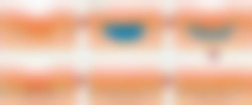 不同术式对麻醉方式有什么要求?