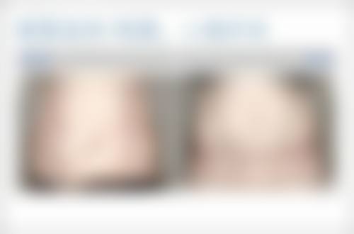 问题三:放射治疗是怎么回事,适用于什么情况呢?