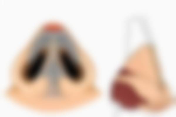 北京蕾士悦容医疗美容门诊部Fotona4D项目体验，真的能看到成效吗？