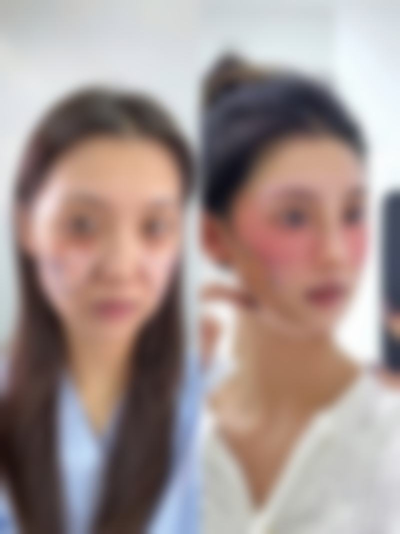 巴中双均整形美容医院正规吗？