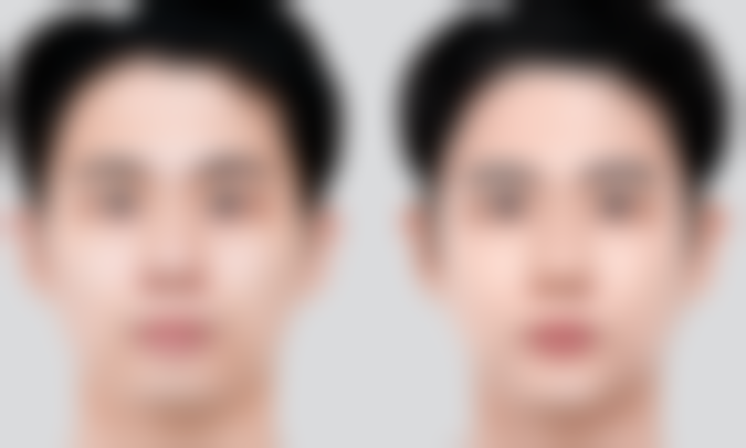 聊城韩美整形美容医院口碑评价怎么样？