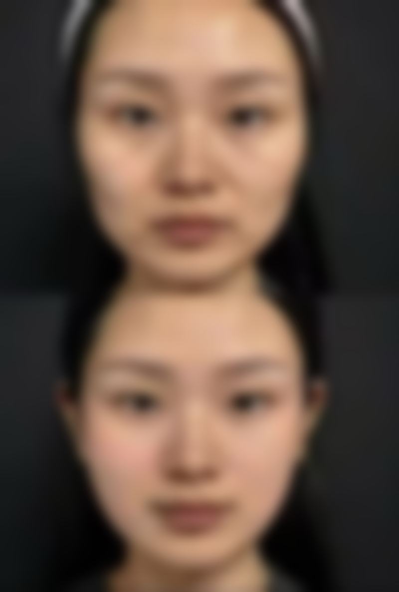 NANA整形外科怎么预约