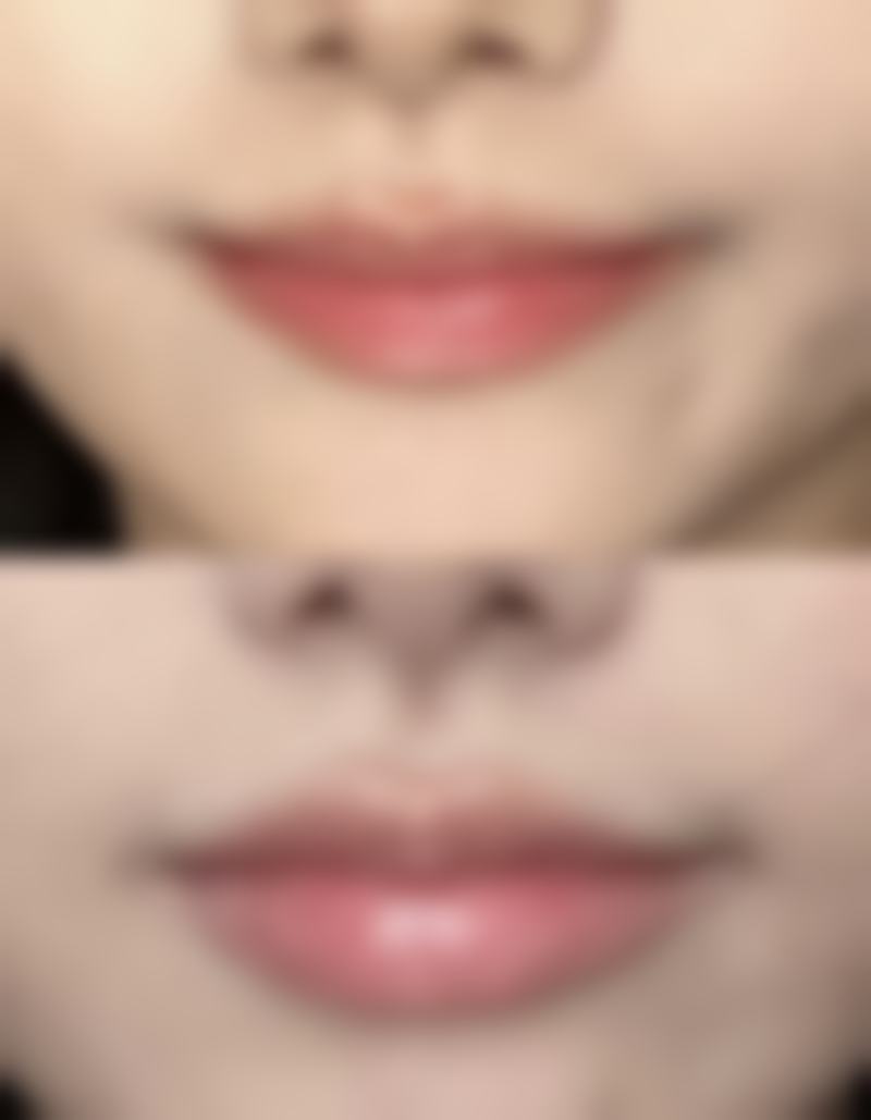 上海纽菲思整形(长宁新容店)怎么预约