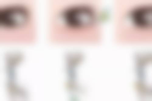 治疗疤痕有哪些注意事项呢?