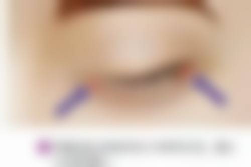 武汉忆美凯德整形医院许辉医生形体雕塑技术怎么样？