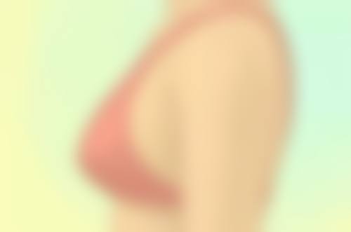 节育环和缩阴手术在手术部位上有什么关系？